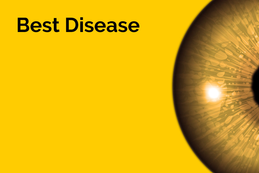 The words 'Best Disease' are displayed in large letters. Half of an eyeball is also displayed against a yellow background.