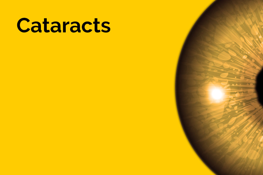 The word 'Cataracts' is displayed in large letters. Half of an eyeball is also displayed against a yellow background.