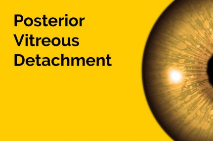 The words 'Posterior Vitreous Detachment' are displayed in large letters. Half of an eyeball is also displayed against a yellow background.
