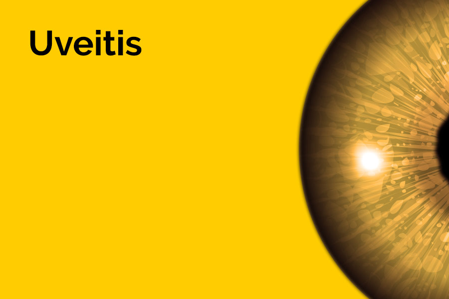 The word 'Uveitis' is displayed in large letters. Half of an eyeball is also displayed against a yellow background.
